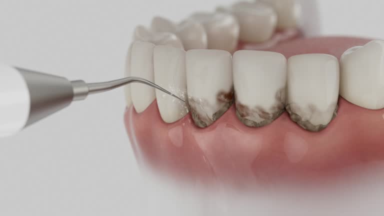 Reliable Dental Implants contractor in Georgetown, OH by Smile Center Dentistry
